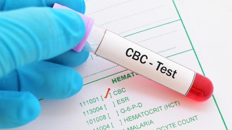 Xét nghiệm máu (Công thức máu toàn phần - CBC)